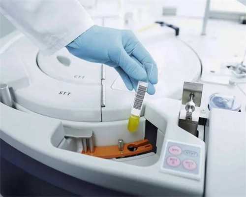 <b>哪里代孕成功率最高,13号染色体三体风险有哪些</b>