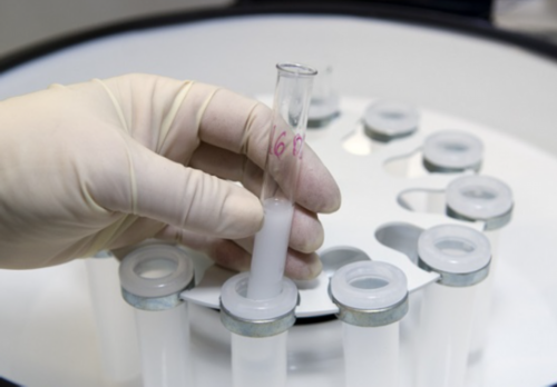 代孕包生女儿_代生子包男孩价格,孕期知识解析:3个小技巧教你读懂孕酮检测报