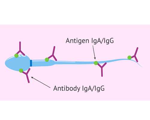 
              生精胶囊和生精片有什么区别，哪个效果更好？
            