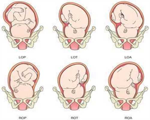 代代孕期有这5个小特征，是小棉袄的机会比较大