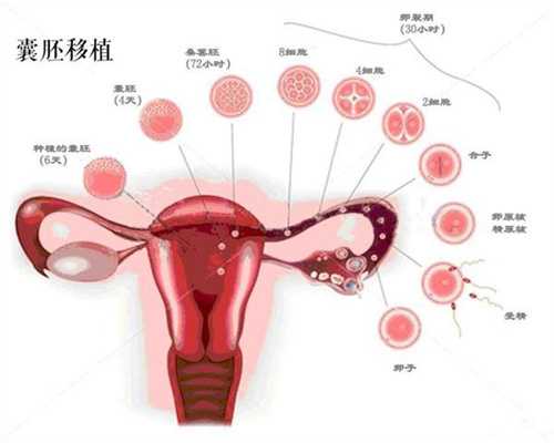淄博代孕2020：卵巢癌的治愈机率有多高