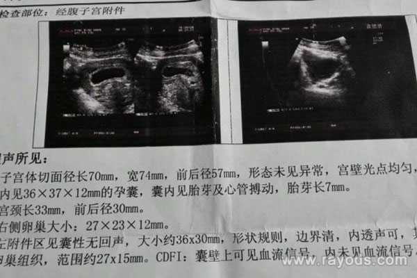 哈尔滨助孕男孩，哈尔滨试管婴儿医院费用多少？